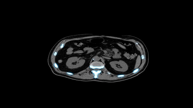 医学MRI扫描屏幕，CT或CAT扫描图像视频素材