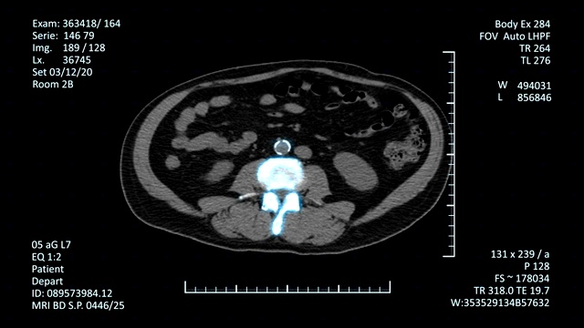 高科技放射检查图像视频素材