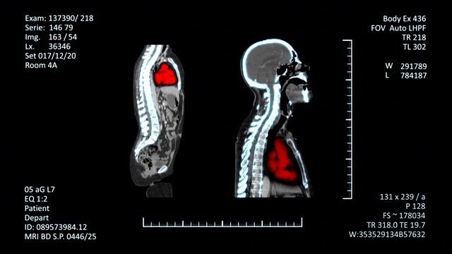 医学MRI扫描仪显示，CT或CAT图像视频素材