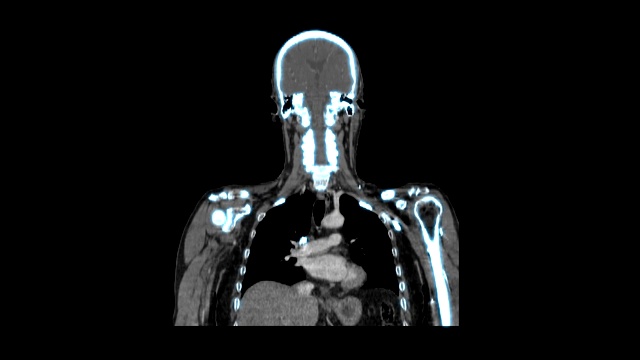 医学MRI扫描屏幕，CT或CAT图像视频素材