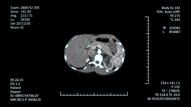 核磁共振扫描显示视频素材