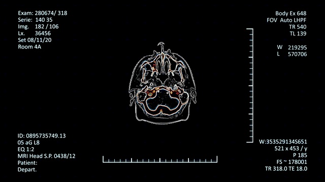 未来的放射学检查视频素材