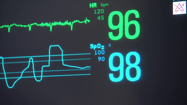 医院的心率监测器视频素材