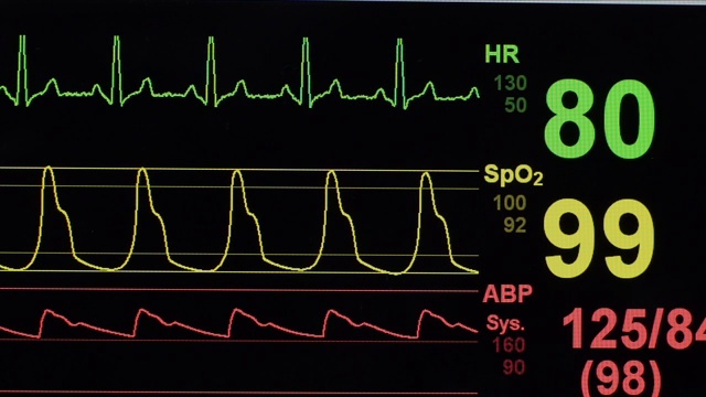 医院的心率监测器视频素材