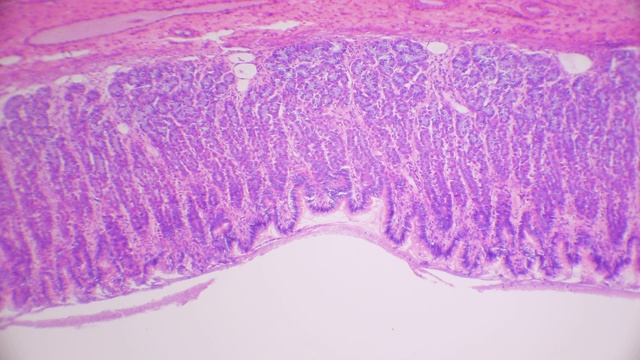 胃贲门区组织横切面视频素材