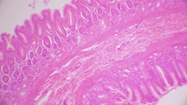 胃幽门区组织横切面视频素材
