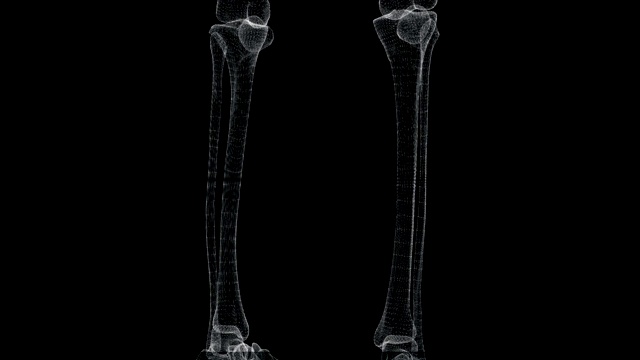 骨盆和腿部骨骼的全息图通过屏幕循环视频素材