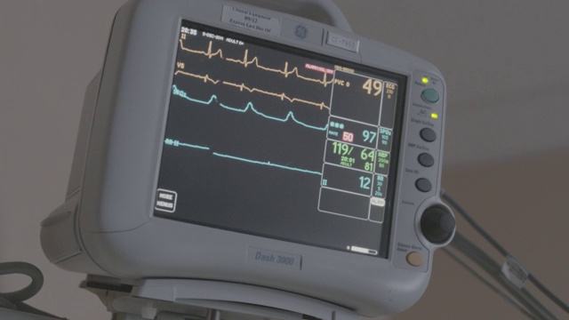 医院、医疗中心或急诊室心率或心电图监测器的闭合角度。数字显示器或显示器。摄像机放大监控。视频素材