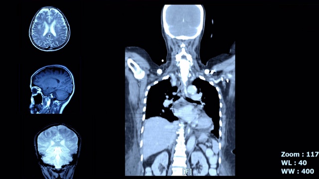 扫描大脑和身体视频素材