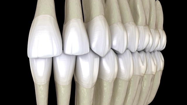 牙齿咬合，宏观视图。医学上准确的牙齿3D动画。视频素材