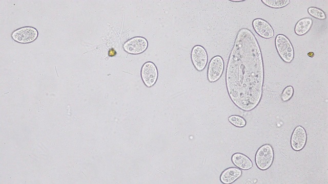 尾草履虫是显微镜下的单细胞纤毛原生动物和细菌属。视频素材