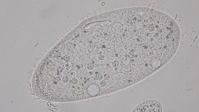 尾草履虫是显微镜下的单细胞纤毛原生动物和细菌属。视频素材