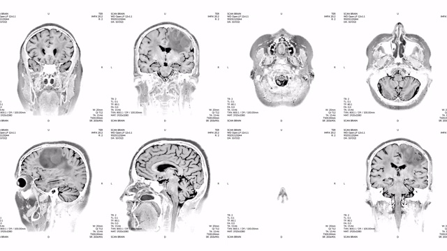 磁共振成像视频墙。白色和黑色的。侧面图。视频素材