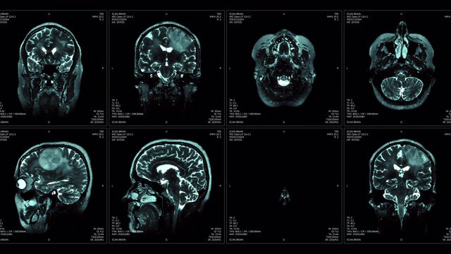 磁共振成像视频墙。黑色和白色。视频素材