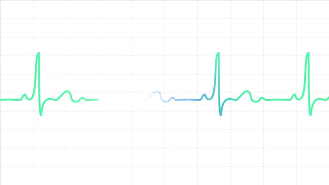心电图心脏监测仪在白色网格上显示脉冲视频素材
