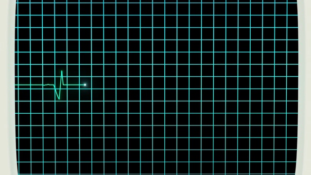 心跳线反射在显示器上，3d渲染。视频素材