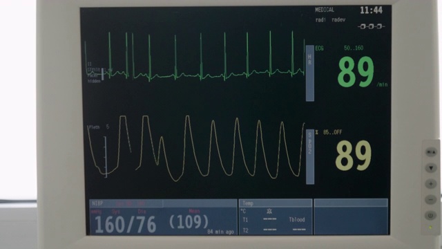 医院。铜、环境、社会和治理监控。生命体征监护仪显示心电图波形。急诊室。视频素材