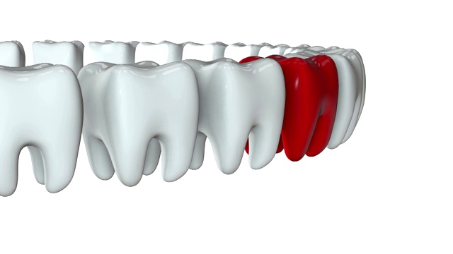 红牙排成一排白牙。3 d渲染。牙科，挤出人群，经营理念。视频素材