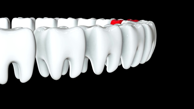 红牙排成一排白牙。3 d渲染。牙科，挤出人群，经营理念。视频素材