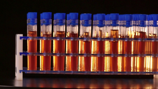 在医学实验室，装有橙色液体的试管在旋转视频素材