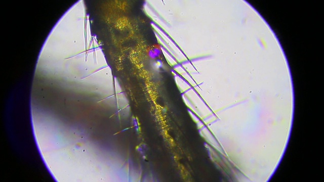 显微镜下的蜘蛛腿视频素材