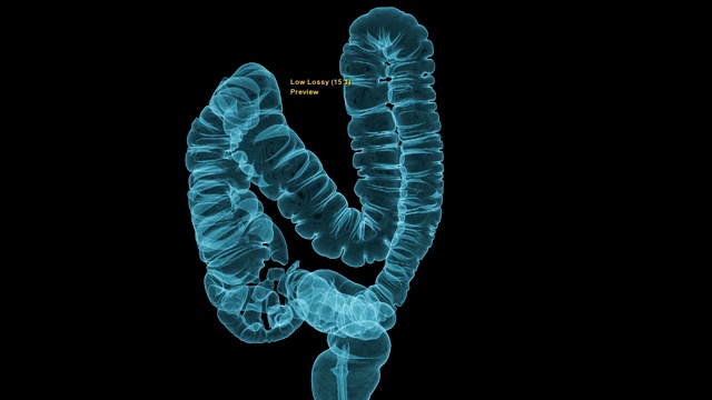 CT结肠造影或CT扫描结肠3D渲染图像。视频素材