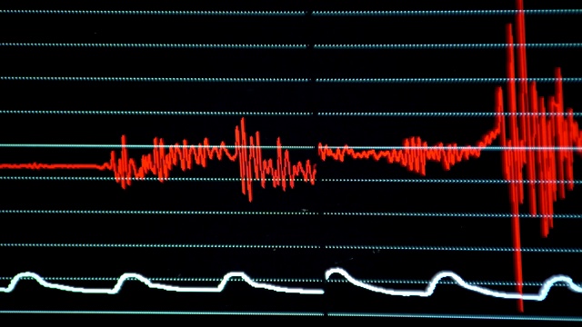 用于医疗办公、临床监测、科研等视频素材