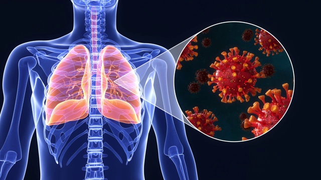 新型冠状病毒感染肺部三维动画视频素材