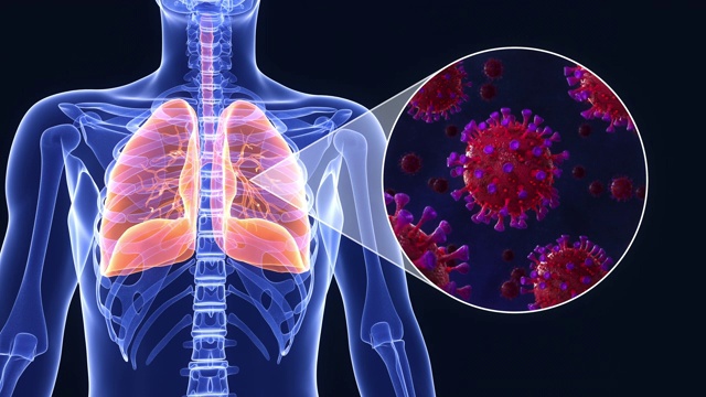 新型冠状病毒感染肺部三维动画视频素材