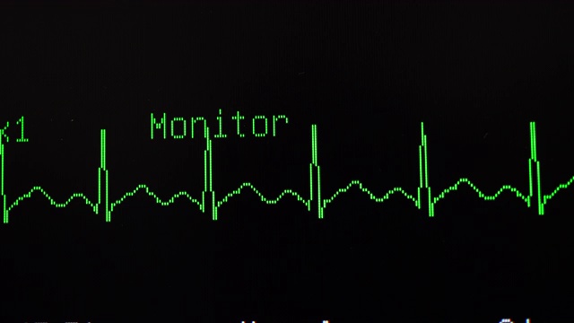 心电图视频素材