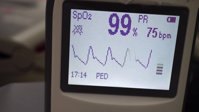 脉搏血氧计视频素材