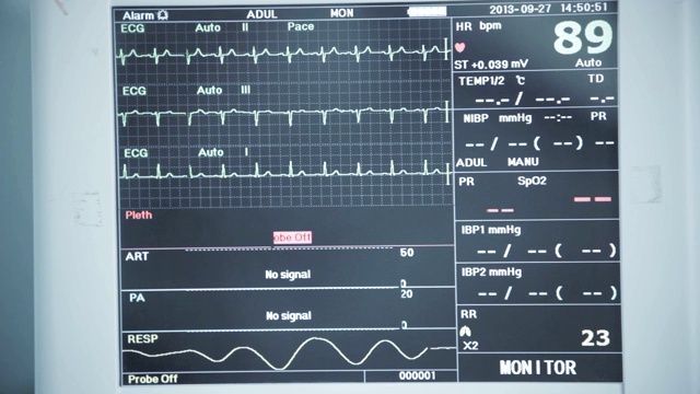 环境、社会和治理监控。生命体征监护仪显示心电图波形视频素材