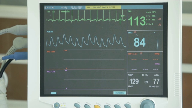 环境、社会和治理监控。生命体征监护仪显示心电图波形视频素材