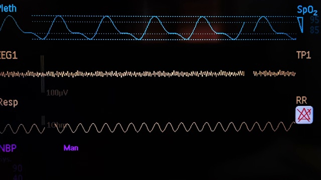生命体征监测视频素材