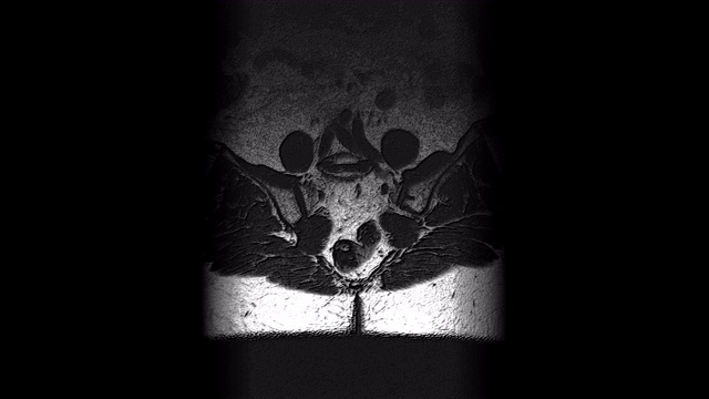 术后女性器官体积MRI检查转移灶视频素材