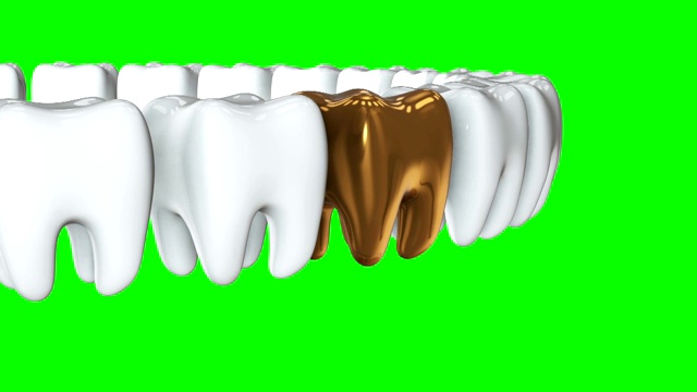 金牙排成一排洁白的牙齿。3 d渲染。牙科，挤出人群，经营理念。视频素材