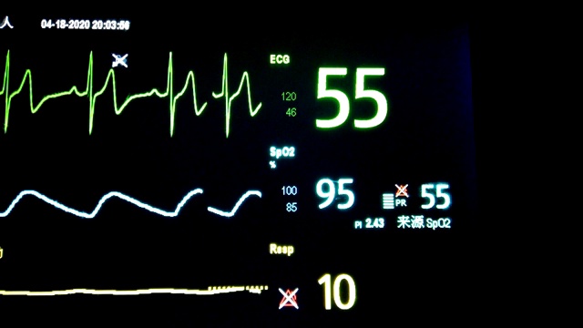 心电图监测视频素材