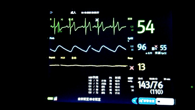 心电图监测视频素材