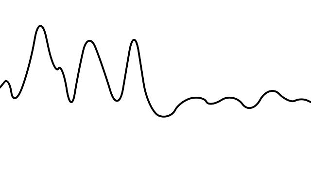 运动图形绘图的音频波，心跳或声波。2 d动画4 k视频素材