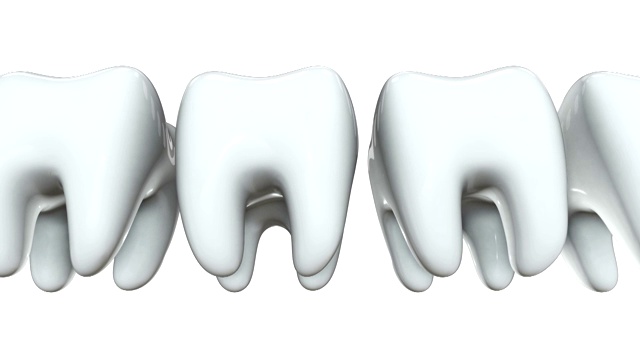 红牙排成一排白牙。3 d渲染。牙科，挤出人群，经营理念。视频素材
