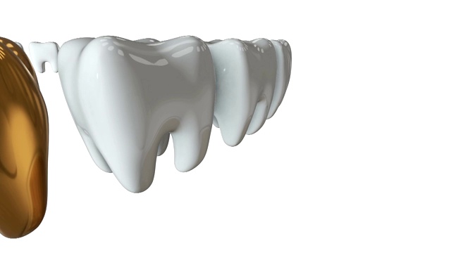 金牙排成一排洁白的牙齿。3 d渲染。牙科，挤出人群，经营理念。视频素材