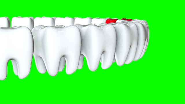 红牙排成一排白牙。3 d渲染。牙科，挤出人群，经营理念。视频素材