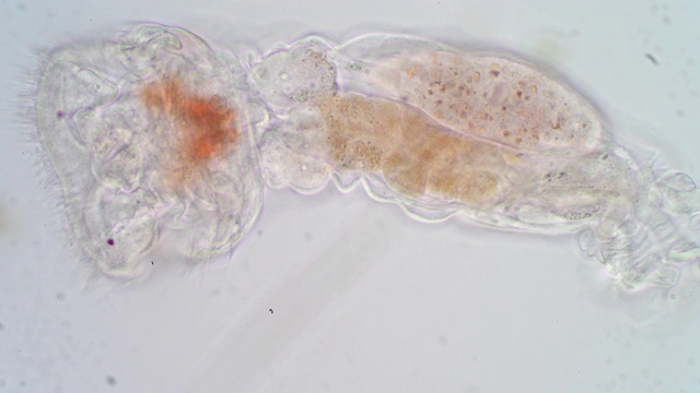 轮虫(Rotifera，俗称轮虫)在显微镜下进行教育。视频素材