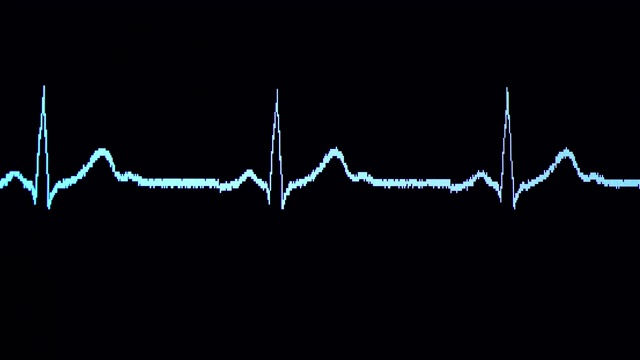 心电图波从视频素材