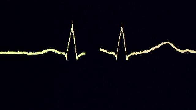 ECG 波从第视频素材