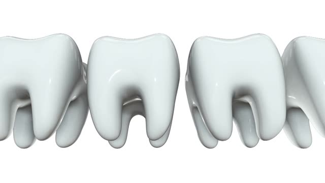 金牙排成一排3D白牙视频素材