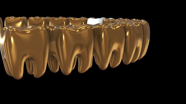 白牙排成一排金牙。3 d渲染。牙科，挤出人群，经营理念视频素材