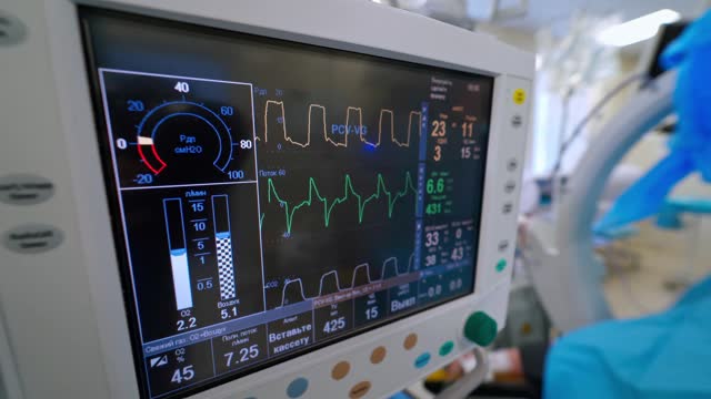 重症监护室配有人工肺通气监护仪。给肺充氧。COVID-19和冠状病毒鉴定。视频素材
