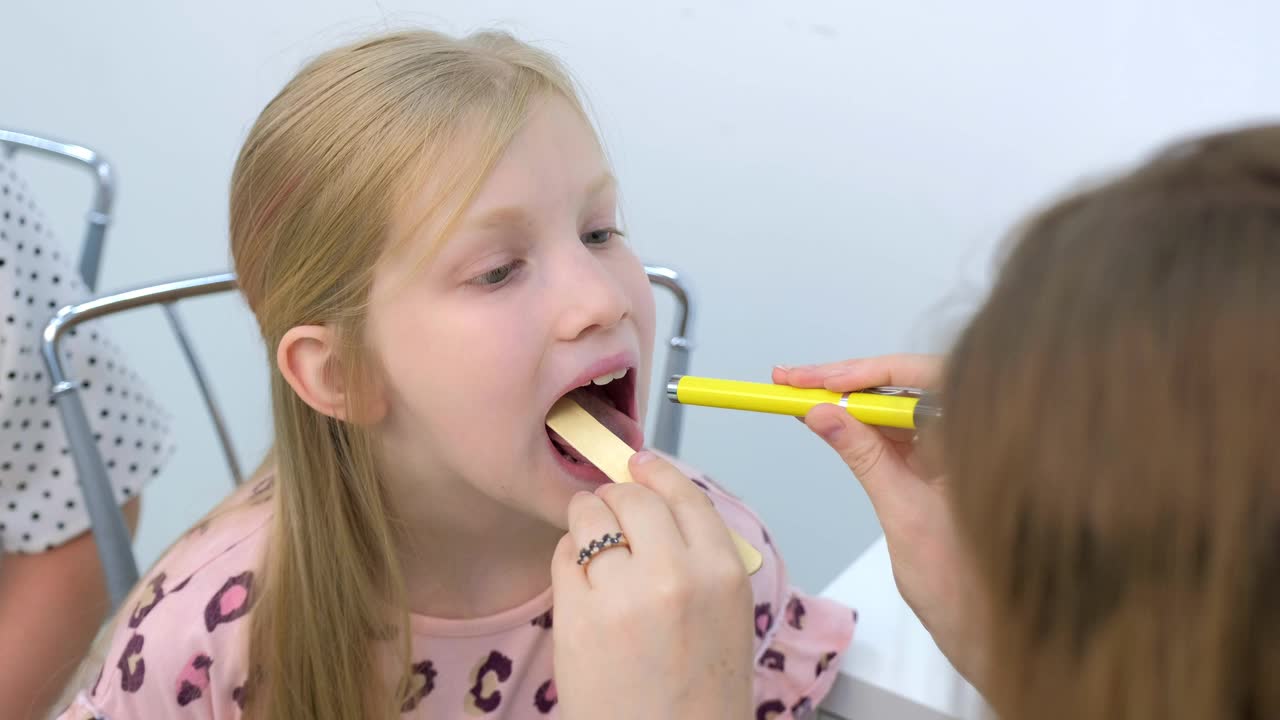 儿科医生用刮刀和提灯检查女孩喉咙痛。视频素材