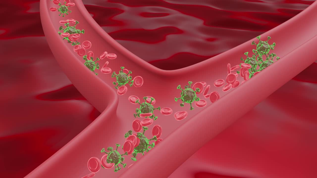 血管内冠状病毒或COVID-19病毒感染。视频下载